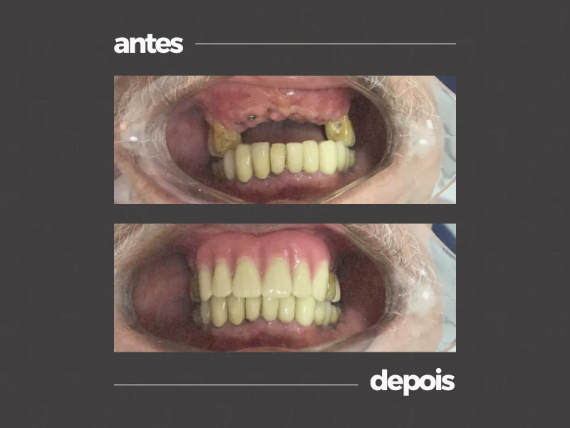 Comparativo clínico antes e depois, caso 12